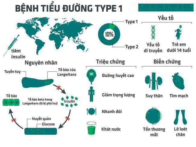 Hình 1. Sơ đồ mô phỏng của bệnh tiểu đường type 1