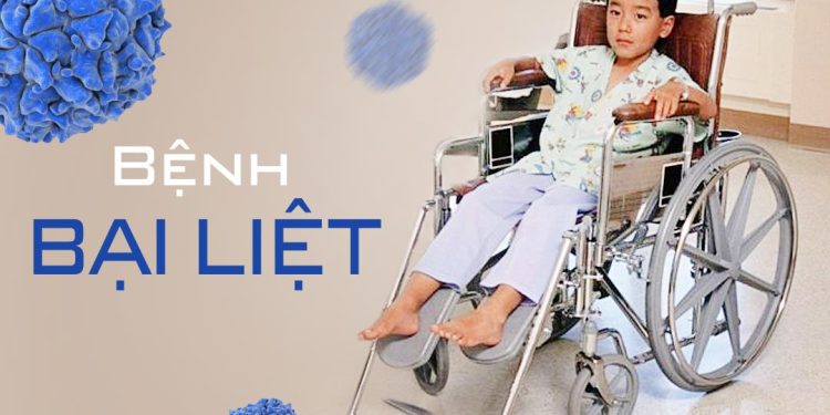Bệnh bại liệt ( Poliomyelitis )