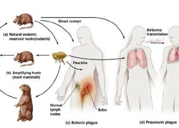 Bệnh dịch hạch ( plague )