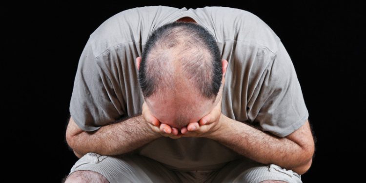 Các loại thảo mộc chữa hói đầu