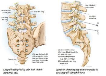 Các hội chứng bệnh vùng cột sống cổ