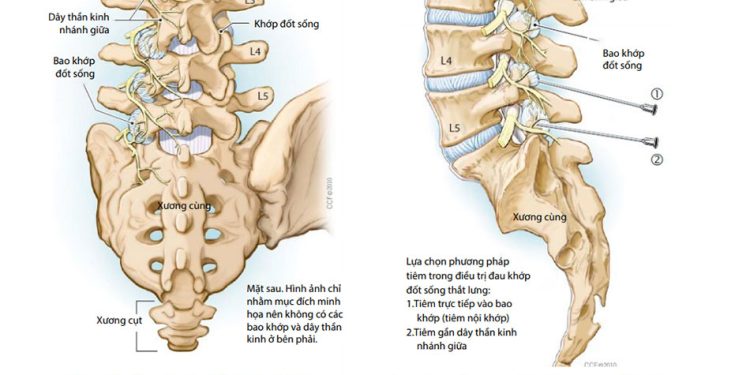 Các hội chứng bệnh vùng cột sống cổ