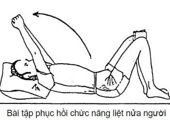 Các bước luyện tập cho người liệt nửa thân