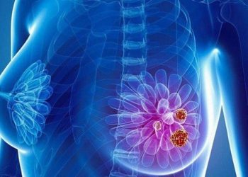 Thuốc ức chế Aromatase phòng và điều trị ung thư vú sau mãn kinh