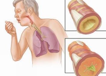 Chúng tôi nghiên cứu chữa hen và  COPD thế nào