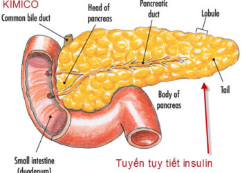 Cơ chế phá hủy tế bào Beta đảo tụy( bài lược dịch)
