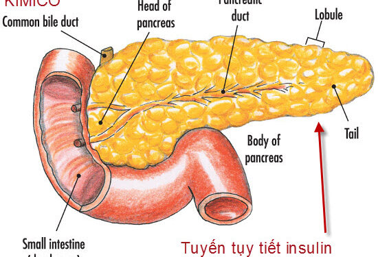 Cơ chế phá hủy tế bào Beta đảo tụy( bài lược dịch)