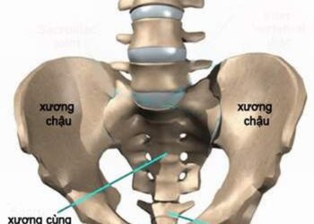 Khung chậu sản khoa