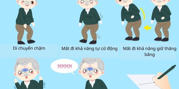 BỆNH SINH CỦA BỆNH PARKINSON