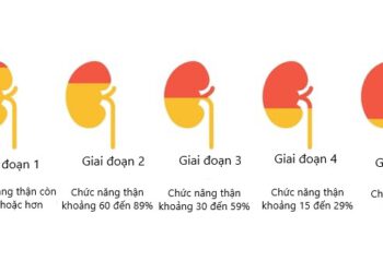 Suy thận độ 5 – nhân một trường hợp hy hữu