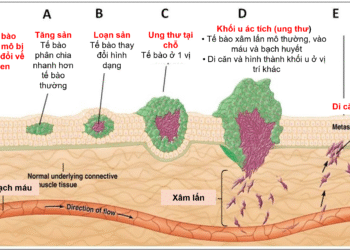 Thuốc đông – nam dược với bệnh ung thư