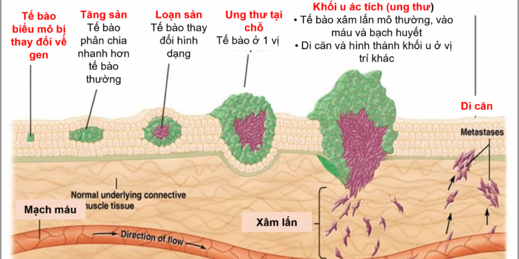 Thuốc đông – nam dược với bệnh ung thư
