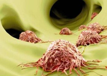 Chiến lược chống di căn và chống tế bào gốc ung thư là nhiệm vụ trọng tâm