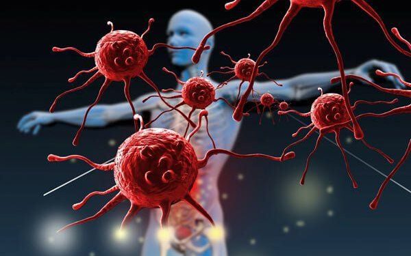 Quan hệ viêm – ung thư