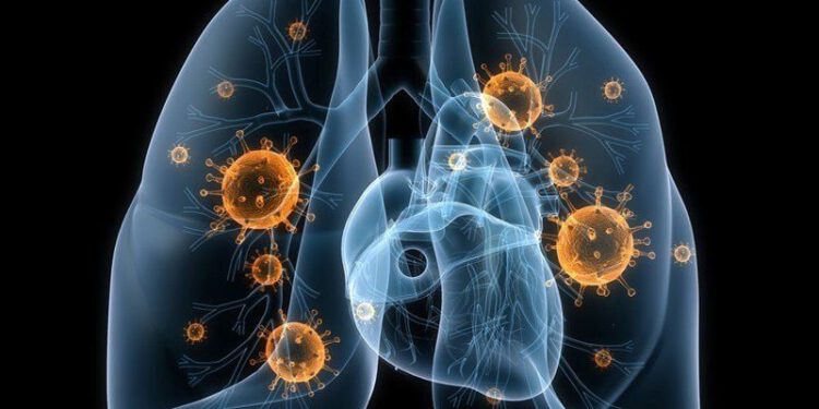 Ung thư phổi tế bào nhỏ – Ám ảnh nỗi bất lực của thầy thuốc?