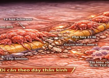 Ung thư di căn, di cư theo hệ sinh thái dây thần kinh đi khắp cơ thể (PNI) – đường di căn chưa được chú ý đúng mức.