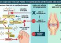 Bệnh gout: Chặn sinh tổng hợp purine từ thượng nguồn và triển vọng kiểm soát triệt để bệnh gout